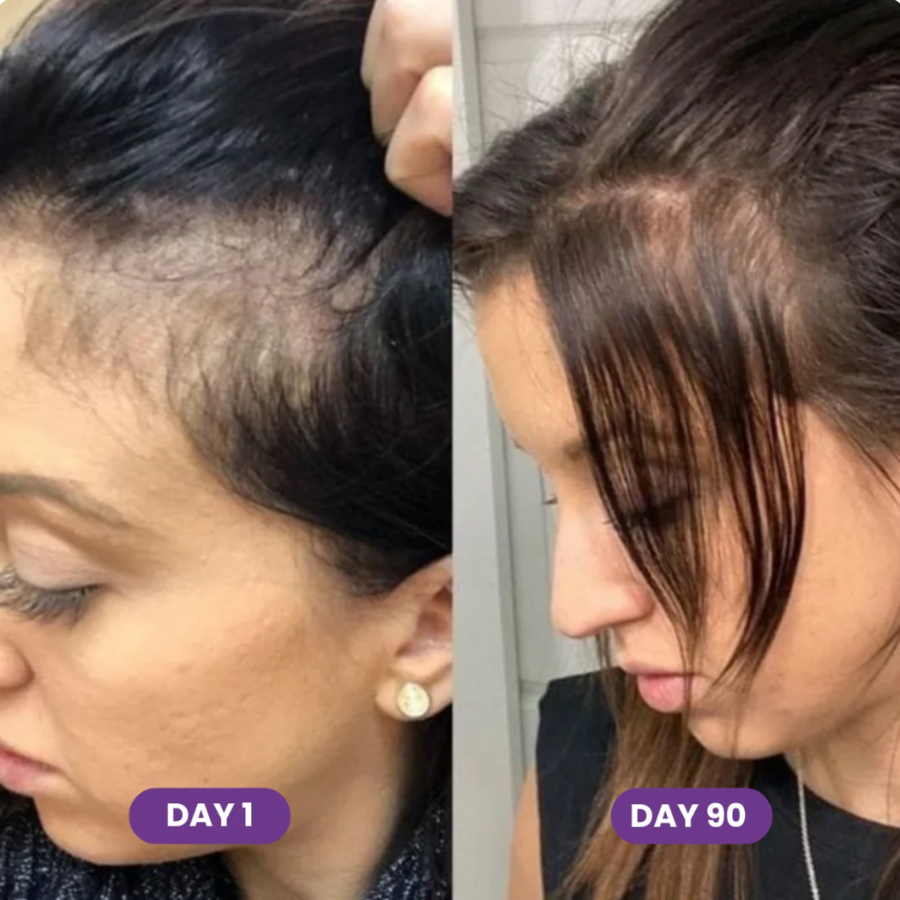 Novora - Soft Chew Hair Growth Accelerator