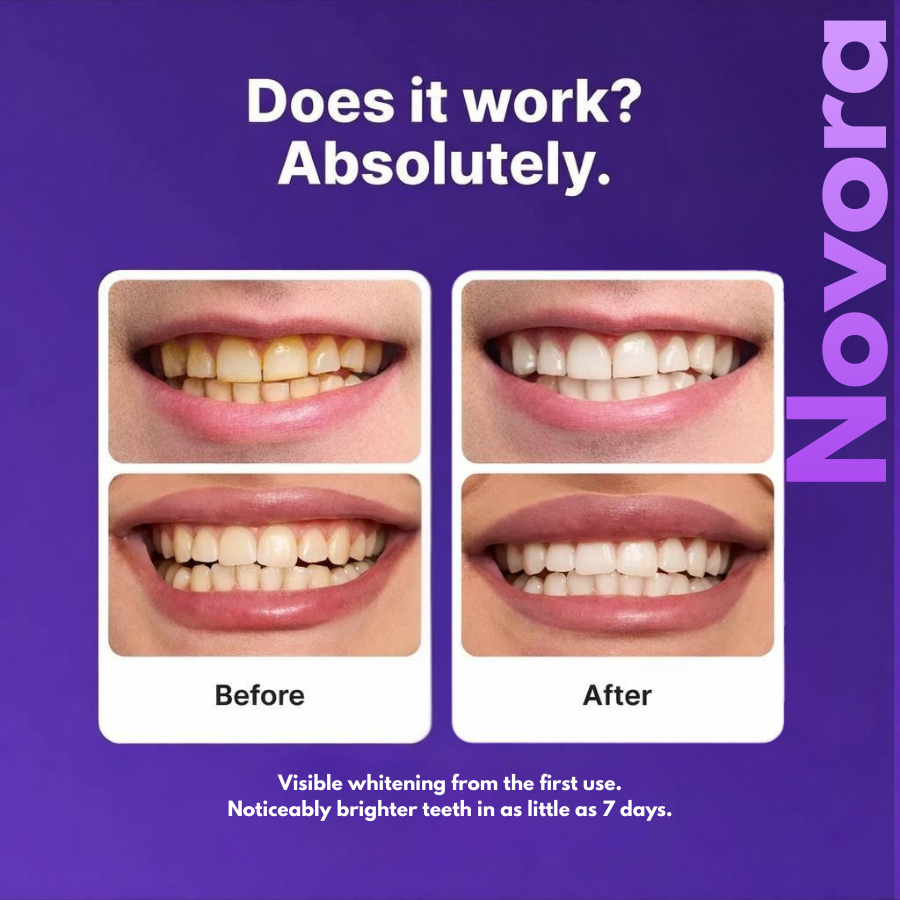 Novora Purple Teeth Whitening Strips™