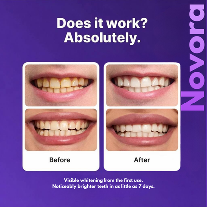 Novora Purple Teeth Whitening Strips™